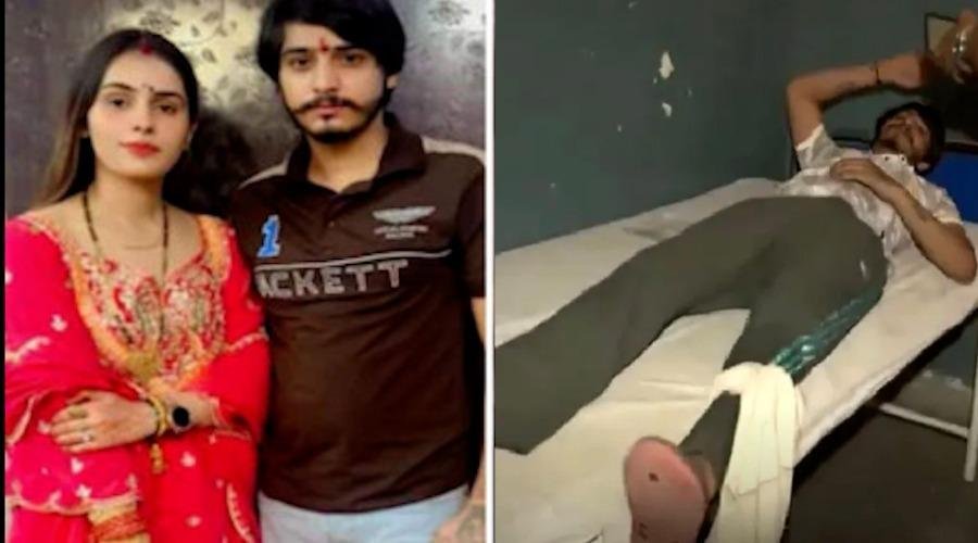 “मुझे कोई पछतावा नहीं…वो खुद मरी”-एनकाउंटर के बाद बोला पत्नी को जिंदा जलाने का आरोपी पति